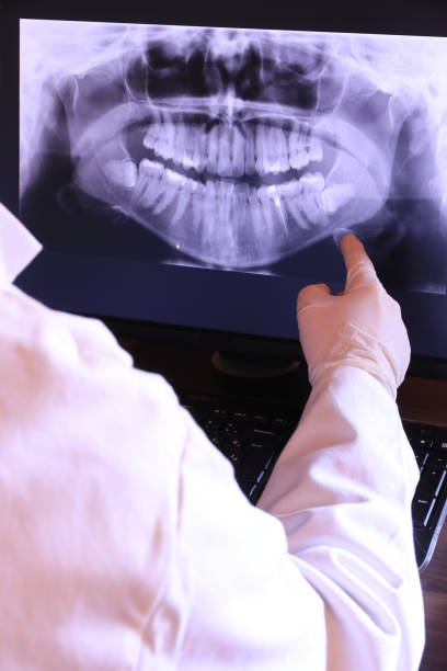 Best Teeth Whitening  in Pocola, OK